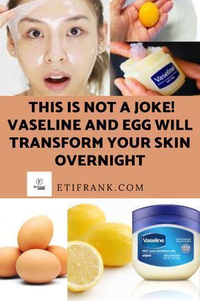 skin care #BrownSpotsInSkinFolds Clear Skin Face Face Skin Care Face Face Beauty Tips For Glowing Vaseline Uses For Face, Face Wrinkles Remedies, Wrinkles Remedies Face, Natural Facial Mask, Vaseline Uses, Wrinkles Remedies, Wrinkle Remedies, Natural Face Skin Care, Skin Care Wrinkles