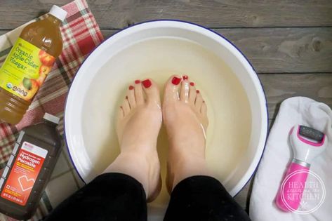 Diy Pedicure Soak, Remedies For Cracked Heels, Homemade Foot Soaks, Pedicure Soak, Diy Foot Soak, Peroxide Uses, Foot Soaks, Hydrogen Peroxide Uses, Diy Pedicure