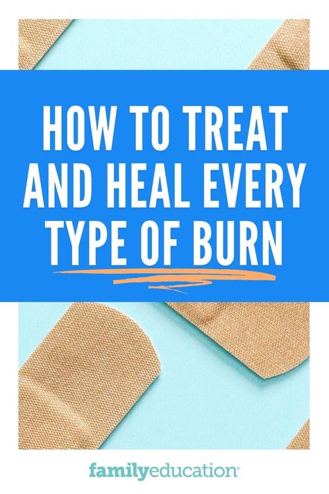 Find out everything you should do when treating first-degree burns, second-degree burns and third-degree burns. #firstaid Skin Burn Remedy, How To Heal Burned Skin, How To Treat A Burn Skin, 1st Degree Burns, Burn Relief Skin, Second Degree Burn Healing, Burn First Aid, How To Heal A Burn Quickly, Second Degree Burn