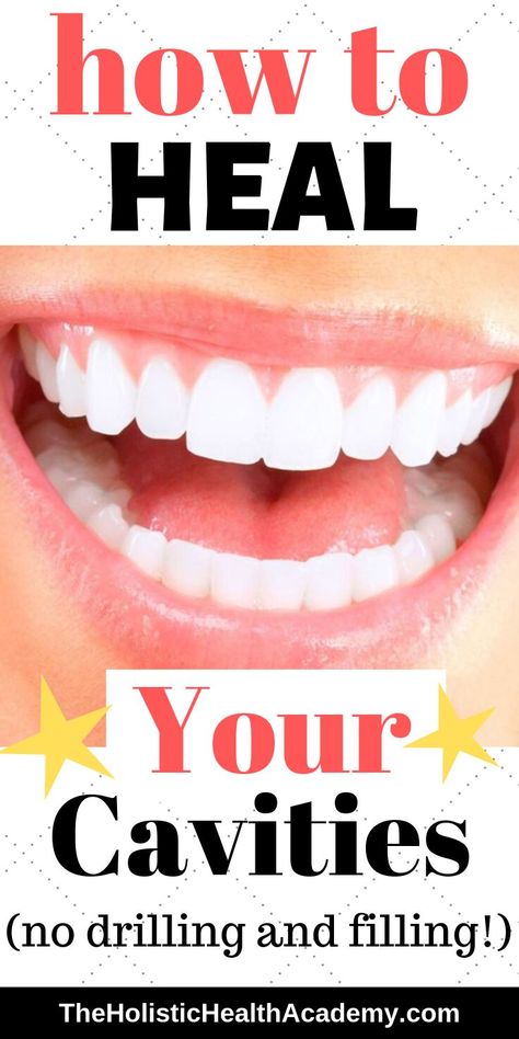 Reverse Receding Gums, Grow Back Receding Gums, Natural Antimicrobial, Fix Teeth, Reverse Cavities, Holistic Dentistry, Tooth Decay Remedies, Heal Cavities, Healthy Gums