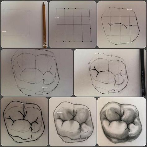 Dentistry Art Ideas, Dental Anatomy Art, Endodontics Art, Dentist Drawing, Prosthodontics Dentistry Art, Good Teeth, Teeth Anatomy, Teeth Drawing, Dental Assistant Study