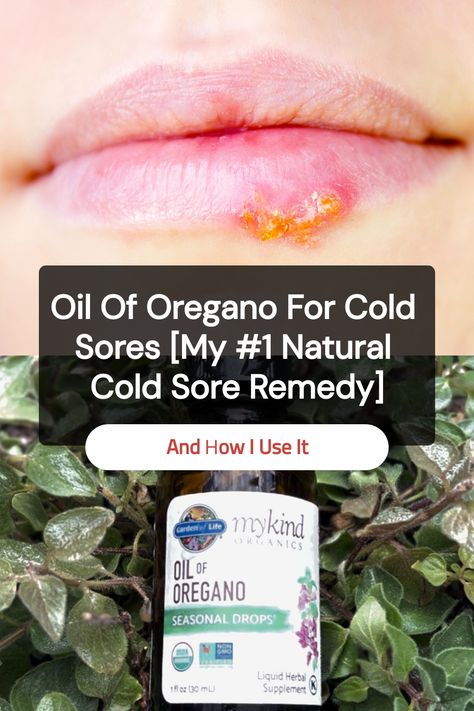 Save this pin to learn how I use oil of oregano for cold sores. If you’re looking for a natural cold sore remedy that packs a punch, this might become one of your favorites, too. Essential Oil For Cold Sore On Lip, Home Remedies For Cold Sores, Diy Cold Sore Remedy Fast, Cold Sore Remedy Fast, Heal Cold Sores Fast, Cold Sore Remedy Overnight, Cold Sore Remedy, Cold Sore Essential Oil, Natural Cold Sore Remedy