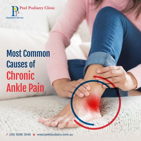 Common Causes of Chronic Ankle Pain Podiatry Clinic, Ankle Pain, Well Read, Activity Days