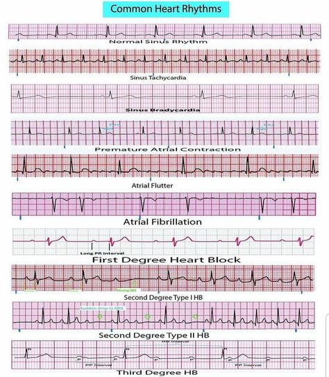 A comprehensive field reference for 12 lead EKG interpretation Field Reference, Ekg Rhythms, Cardiothoracic Surgeon, Fitness Assessment, Cardiology Nursing, Ekg Interpretation, Ecg Interpretation, Cardiac Rhythms, Nursing Cheat