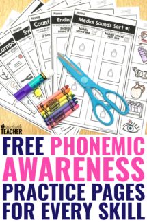 Teacher Communication Log, Phonemic Awareness Kindergarten, Phonics Assessments, Phonological Awareness Activities, Phonemic Awareness Activities, Free Kindergarten Worksheets, 2nd Grade Worksheets, Resources For Teachers, Phonological Awareness