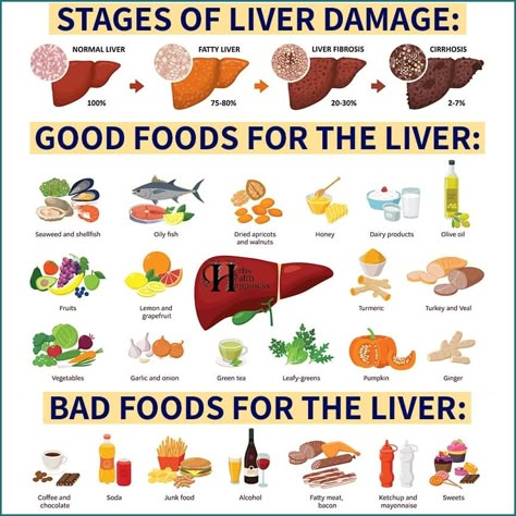 Foods For Liver Health, Liver Healthy Foods, Healthy Liver Diet, Liver Care, Chocolate Bacon, Liver Diet, Liver Detoxification, All Body Workout, Cold Symptoms