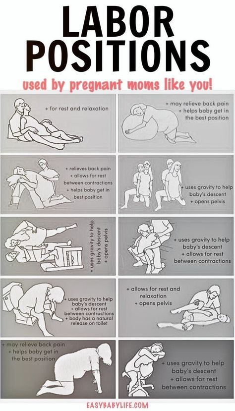 Looking for the best labor positions for easier childbirth? It is still quite common to lie flat on your back during labor and delivery despite being one of the worst birth positions! Curious about which positions other pregnant moms used? Check out this survey of more than 500 moms (and share your own experience)!   Important childbirth education and preparation, pregnancy care, pregnancy help for easy labor, and unmedicated birth tips. Birth Positions, Labor Positions, Birth Prep, Baby Weeks, Birth Tips, Pregnancy Facts, Unmedicated Birth, Easy Labor, Pregnancy Help