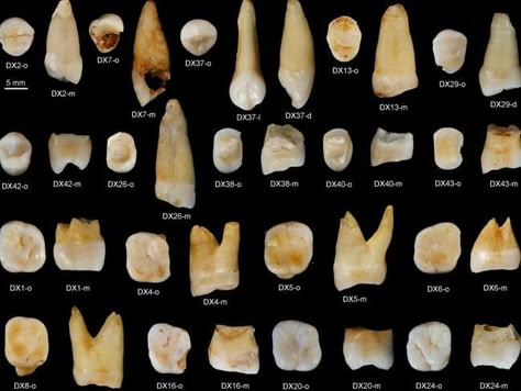 Ancient human teeth discovered in China could rewrite the historic migration map of Homo sapiens Human Teeth, Bone Crafts, Vulture Culture, Dental Art, African Continent, Creepy Crawlies, Human History, Tooth Decay, Tooth Fairy