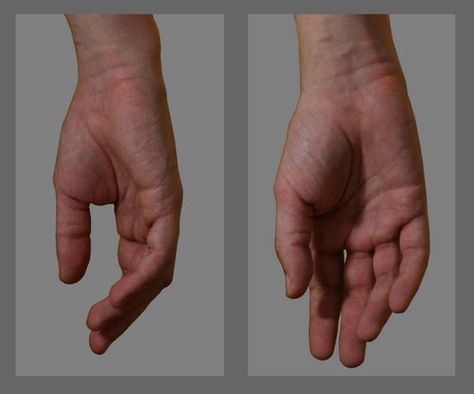 Hands Front View Reference, Sideways Hand Reference, Relaxed Hand, Hand Ref, Human Anatomy Reference, Hands Reference, Hand References, Rise Of The Tomb Raider, Hand Poses