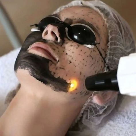 Hollywood Peel, Carbon Facial, Carbon Peel, Onion Hair Growth, Eyebrow Tattoos, Laser Peel, Onion Hair, Lip Lightening, Remove Skin Tags Naturally