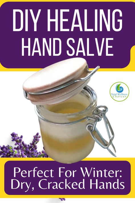 Winter can be especially hard on our hands. If you are like me you may not protect your hands from the harsh, winter elements (as in don’t wear gloves). This is a great recipe if you have dry, cracked hands like I do in winter….. Dry Hands Remedy, Homemade Toiletries, Hand Cream Recipe, Diy Hand Cream, Hand Cream Homemade, Beeswax Recipes, Essential Oils For Healing, Homemade Balm, Oils For Healing