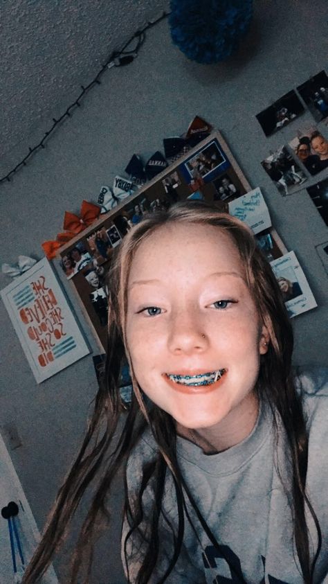 Turquoise, light blue, dark blue are my favorite colors so I got it on my braces. Definitely recommend getting a bluish color like mine! Bright Blue Braces, Braces Light Blue, Braces Preppy, Turquoise Braces, Dark Blue Braces, Light Blue Braces, Braces For Teeth, Blue Braces, Braces Colors Ideas