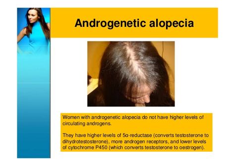 Androgenetic alopecia in Women ...scary because this type of hair probably will never grow back Thicker Hair Remedies, Androgenic Alopecia, Thick Hair Remedies, Thick Hair Growth, Skin Care Pictures, Hair Growth Remedies, Androgenetic Alopecia, Growing Hair, Hair Remedies For Growth