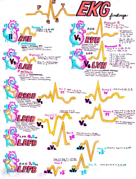 where the art of procrastination meets the study of medicine Normal Ecg, Cardiology Nursing, Paramedic School, Nurse Practitioner School, Nursing Cheat, Nursing Mnemonics, Medical Student Study, Cardiac Nursing, Critical Care Nursing