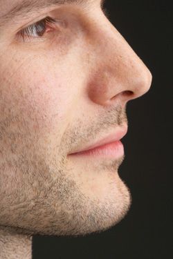 Non-Surgical Rhinoplasty - Restylane® Modesto | SkinRenew Straight Nose Men, Male Nose Job, Nose References, Aesthetic Figures, Nose Surgery Rhinoplasty, Rhinoplasty Nose Jobs, Nose Jobs, Men's Skin Care, Straight Nose