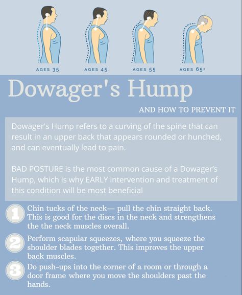 Shoulder Exercises Physical Therapy, Dowager Hump, Dowager's Hump, Upper Back Stretches, Back Strengthening Exercises, Neck And Shoulder Exercises, Neck Hump, Chin Tuck, Bad Posture