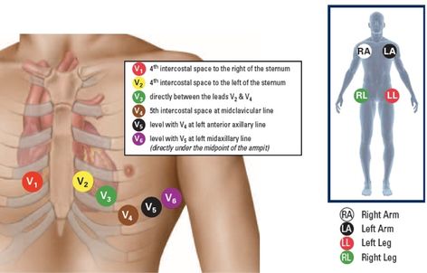 Ekg Placement, Ekg Leads, Phlebotomy Study, Emt Study, Er Tech, Ekg Interpretation, Medical Assistant Student, Nurse Study, Medical Notes