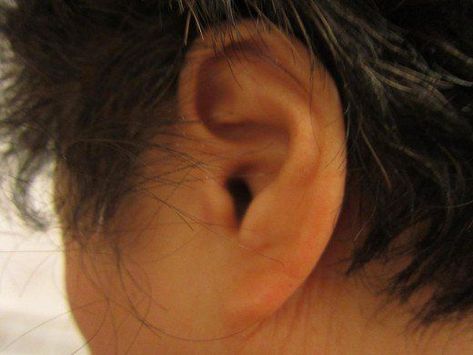 Ringing Ears Remedy, Inner Ear, Medical Terms, Ear Wax, Hearing Loss, Hearing Aids, Natural Treatments, Medical Conditions, Behind Ear Tattoo