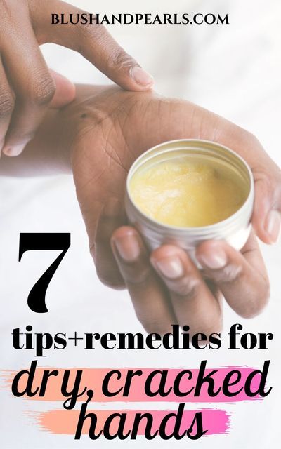 7 Tips + Remedies For Dry, Cracked Hands. Suffering from dry hands from winter weather or extra hand washing? Find out what causes dry hands and 7 ways to remedy cracked hands naturally and easily using the best moisturizers and other tips to increase moisture. | skin care tips for dry skin on hands | dry hands from washing remedy overnight | dry hands from winter | rough hands remedy | #skincaretips #dryhands #dryskin #skincarehacks Dry Hands Remedy Diy, Dry Cracked Hands Remedy, Cracked Hands Remedy, Dry Hands Remedy, Dry Skincare Routine, Extremely Dry Hands, Cracked Heel Remedies, Hand Spa, Dry Hand Skin