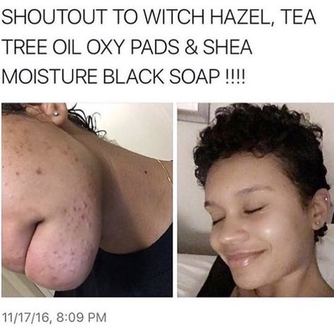 Shea Moisture Black Soap, Cheap Skincare, Clear Blackheads, Baby Skin Care, Daily Skin Care, Body Skin Care Routine, Shea Moisture Products, Diy Skin Care, Healthy Skin Care