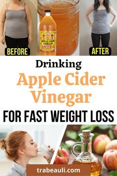 Drinking apple cider vinegar for weight loss fast. Know about how to use it and benefits of it. #ACV #weightloss Drinking Apple Cider Vinegar, Acv Drink, Vinegar Drinks, Lose Stomach, Apple Cider Vinegar Drink, Baking Soda Beauty Uses, Organic Apple Cider, Cold Sores Remedies, Organic Apple Cider Vinegar