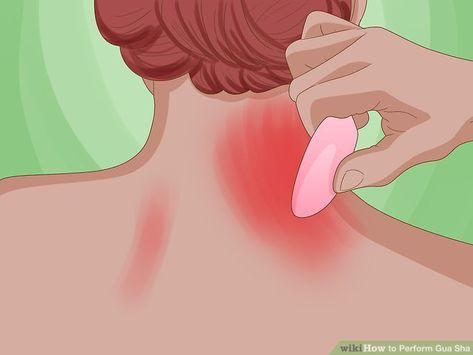 How to Perform Gua Sha: 8 Steps (with Pictures) - wikiHow Gua Sha Neck And Shoulder, Gua Sha Stomach Bloat, Gua Sha Legs Massage, Gua Sha Neck Massage, Gua Sha Body Massage, Gua Sha Guide, Upper Cross Syndrome, Face Firming, Gua Sha Massage