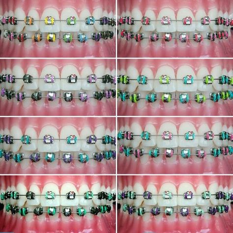 Looking to add some color to your braces? Try one of these combinations at your next appointment Brasses Teeth Color, Braces Colour Ideas, Pretty Braces Colors, Pretty Braces, Braces Colors Combinations, Invisible Teeth Braces, Braces Care, Braces Retainer, Braces Colors Ideas