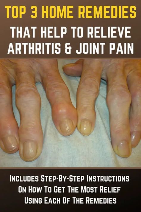 3 Natural Home Remedies That Help To Relieve Arthritis & Joint Pain Homesteading Hacks, Joints Pain Remedy, Pain Relief Remedies, Reduce Swelling, Green Diy, Natural Healing Remedies, Knee Pain Relief, Outdoor Sheds, Joints Pain Relief