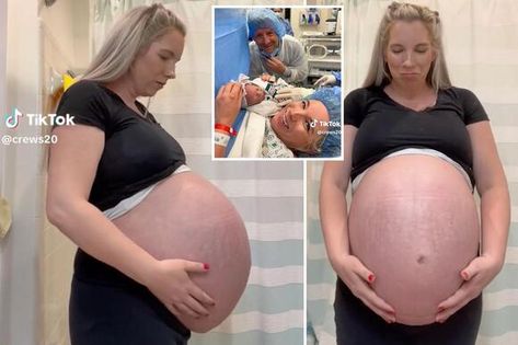 Mom’s giant baby bump that goes ‘straight out’ leaves the internet speechless Triplet Baby Bump, Triplets Pregnancy Belly, Quintuplets Pregnancy, Pregnant With Triplets Belly, Baby Bump Progression, Triplets Pregnancy, Baby In Womb, Big Pregnant, Heavily Pregnant