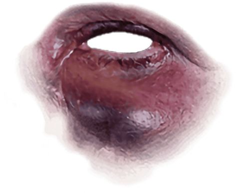 Eye Injury, Graphics Resources, Transparent Image, Image Downloads, Anime Eyes, Eye Black, Free Png, Anime Drawings, Png Images