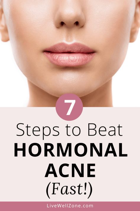 Healthy Skin Care Acne, Get Rid Of Hormonal Acne, Hormonal Acne Diet, Acne Supplements, Hormonal Acne Remedies, Acne Diet, Acne Overnight, Natural Acne, Acne Skincare Routine