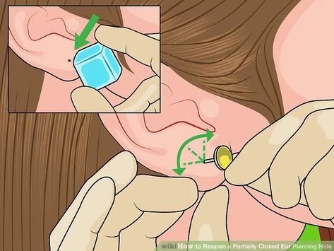 3 Ways to Reopen a Partially Closed Ear Piercing Hole - wikiHow Life How To Repierce Ears At Home, Repierce Ears At Home, Pierce Your Own Ears, Piercing Ears At Home, Starter Earrings, Fluid In Ears, Getting Your Ears Pierced, Diy Cleaner, Ear Peircings