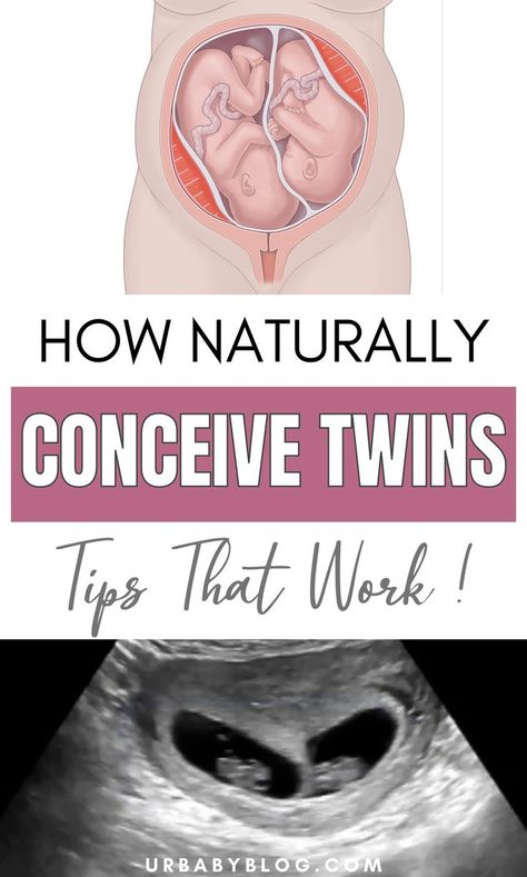 Did you know that you can actually make things work to get pregnant with twins? Yes, it sounds incredible, but there are certain ways that may be of help to you. #twins #conceivetwins #getpregnant #pregnancy #gettingpregnant Conceive Twins, Twin Pregnancy Belly, Get Pregnant With Twins, How To Conceive Twins, Breastfeeding Meal Plan, Getting Pregnant With Twins, Help Getting Pregnant, Getting Pregnant Tips, How To Conceive