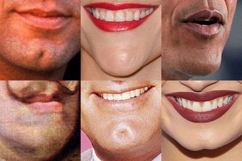 Nubian Nose, Weak Chin, Picture Quiz, Nose Types, Talking Behind Your Back, Kitty Party Games, Health Guru, What Makes You Unique, Nose Shapes