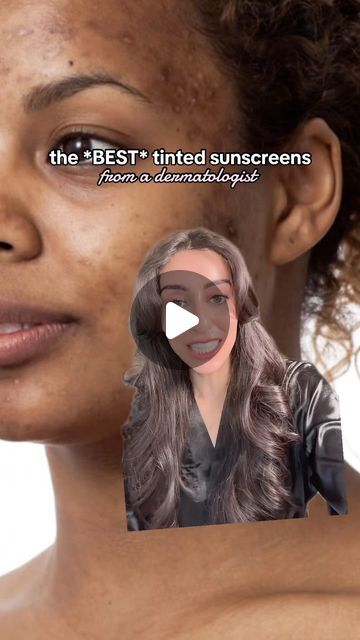 Dr Aamna Adel on Instagram: "FAVOURITE tinted sunscreens 🫶🏼💕☀️  These are some of my tried and tested favourites. What’s your favourite tinted sunscreen?  #dermatology #sunscreen #tintedspf #tintedsunscreen #spf #skincare #skincareroutine #hyperpigmentation #melasma #productrecommendations" Best Tinted Sunscreen, Sunscreen For Acne Prone Skin, Spf Skincare, Tinted Sunscreen, Tinted Spf, Face Sunscreen, Dermatology, Acne Prone Skin, Sunscreen