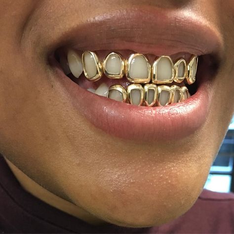 Girl Grillz, Teeth Gems, Grillz Teeth, Future Wear, Statement Piece Jewelry, Big Afro, Diamond Teeth, Juniper Tree, Gold Grillz