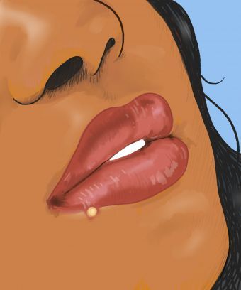 How to tell if you have a pimple, cold sore, or herpes. #Acne #Pimples #ColdSore #Herpes #Skincare #Beauty Pimples Around Lips, Pimples On Lip Line, Lip Pimple, Painful Pimple, Sunburn Peeling, Acne Prevention, Different Types Of Acne, Super Dry Skin, Blind Pimple