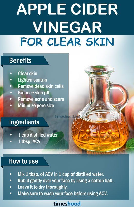 Acv On Face, Get Clear Skin Naturally, For Clear And Glowing Skin, Apple Cider Vinegar Remedies, Apple Cider Vinegar For Skin, Cider Vinegar Benefits, Clear And Glowing Skin, Clear Skin Naturally, Vinegar Benefits