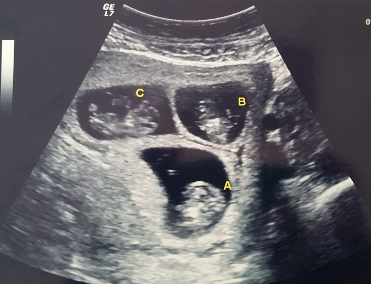 an x - ray shows the chest with two different sections