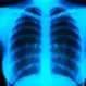 What Is the Treatment for Asthmatic Bronchitis?