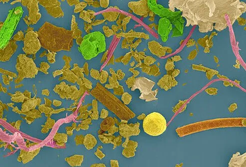 SEM image of pollen dust.