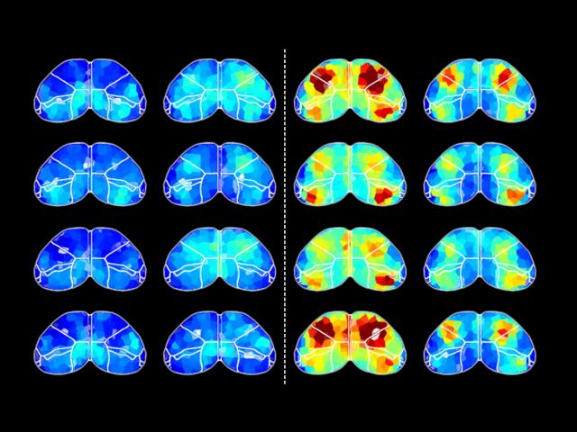 University of California Santa Barbara Neuroscience