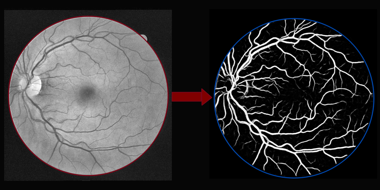 Blood-Vessel-Segmentation