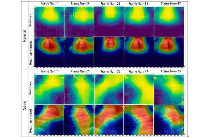 Researchers train AI to diagnose lung diseases