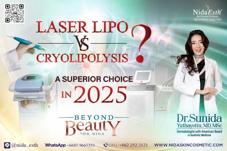 Laser Lipo VS Cryolipolysis A Superior Choice in 2025?