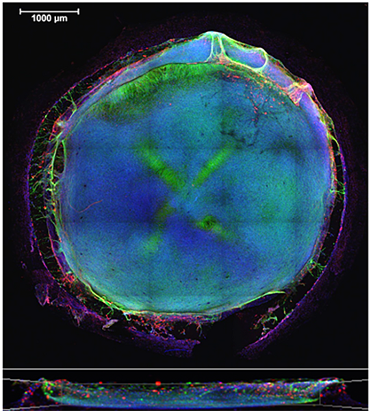 File:Brain Cells (40522751690).png