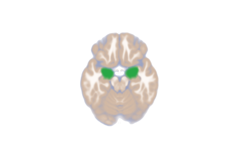 File:Amygdala dorsal slice.png