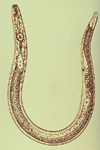 Figure 1. Illustration of adult female lesion nematode showing morphology. (Courtesy Union Carbide)