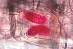 Figure 15. Lesion nematode eggs (stained red with acid fuchsin) laid within a plant root. (Courtesy J. D. Eisenback, NemaPix)