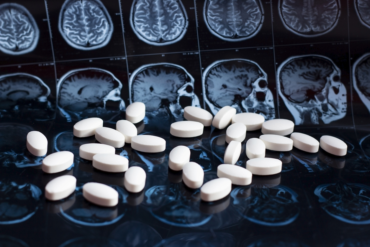 A collection of white pills scattered on top of several MRI scans of a brain. The scans show detailed images of the brain from different angles, providing a backdrop to the medication pills.